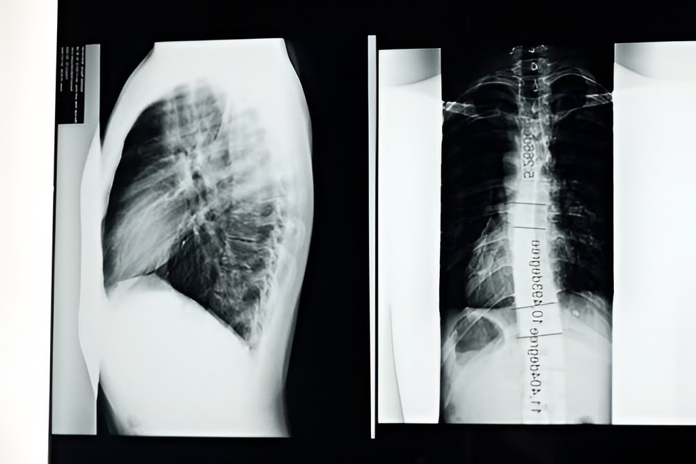 Teknik X-Ray Baru Bisa Gandakan Efisiensi Pemindaian